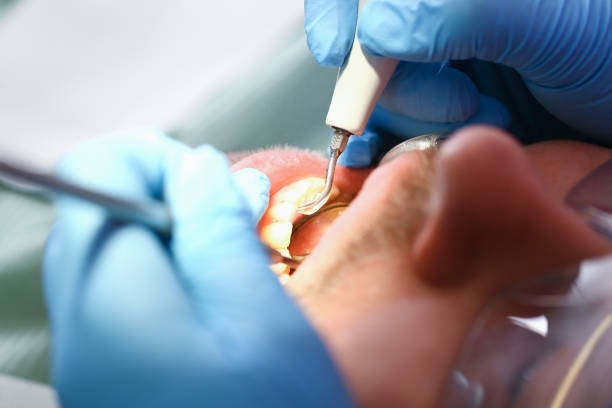 Best Emergency Dental Filling Replacement  in Laguna Vista, TX